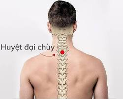 Xoa bóp bấm huyệt chữa đau cổ gáy